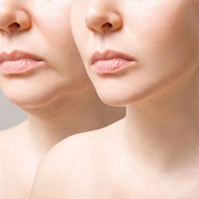 How Can Facial Plastic Surgery Improve Your Professional Image?