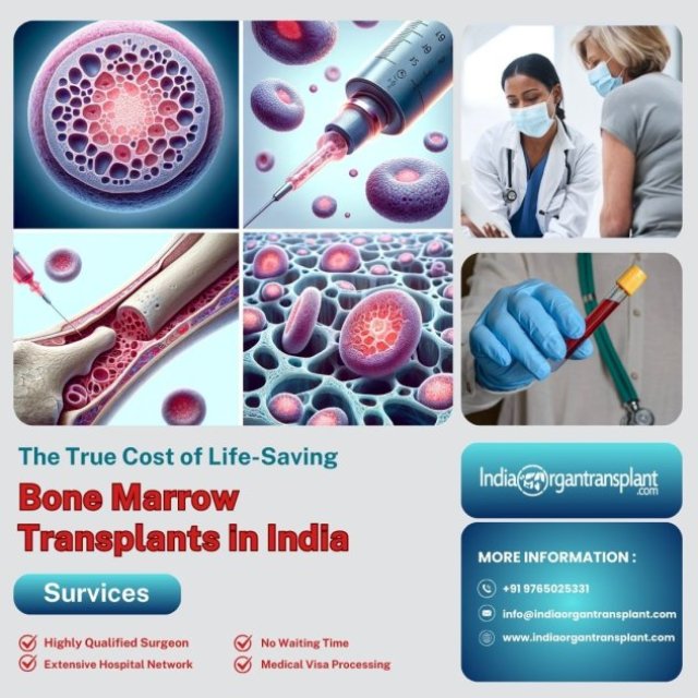 Cheap Cost of Bone Marrow Transplant Surgery in India