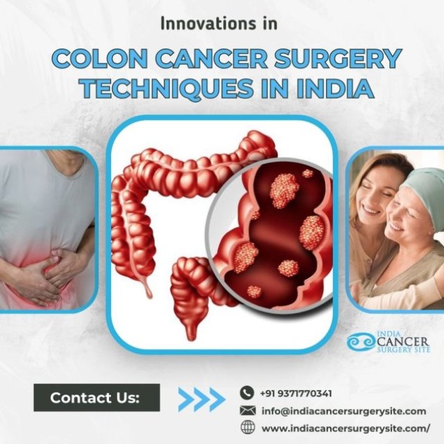 Affordable Cost of Colon Cancer Treatment India