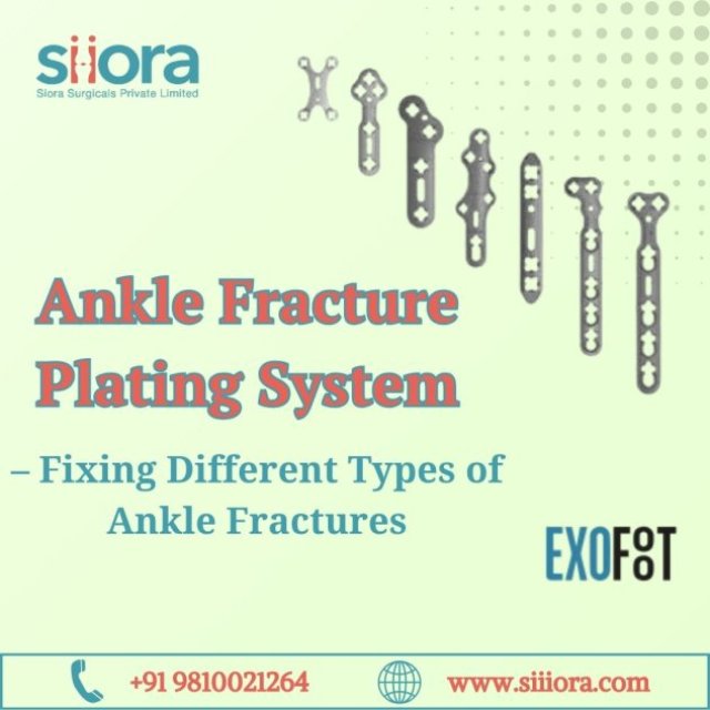 Ankle Fracture Plating System - Fixing Different Types of Ankle Fractures